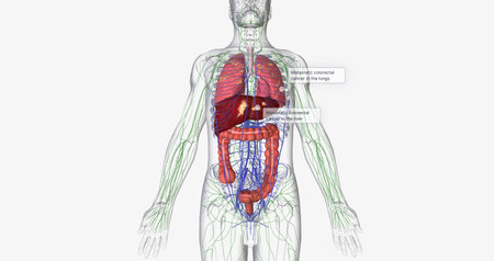 Colorectal cancer (CRC) is a common colon or rectal cancer that affects many patients over middle age. 3D renderingの写真素材