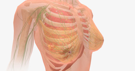 Stage IV breast tumors are invasive and have spread beyond the localized area to the lungs, bones, liver, brain, or to distant lymph nodes. 3D renderingの写真素材