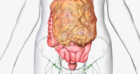Stage III ovarian cancer has spread beyond the pelvis area to the abdomen. 3D renderingの写真素材