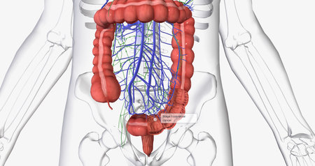 Colorectal cancer (CRC) is a common colon or rectal cancer that affects many patients over middle age. 3D renderingの写真素材