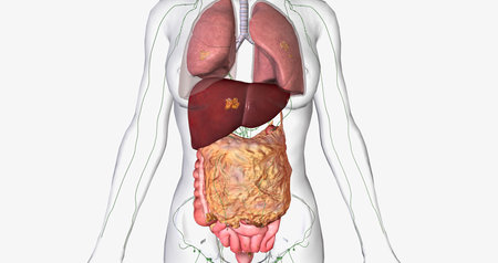 Stage IV ovarian cancer has spread to distant sites such as the lungs and liver. 3D renderingの写真素材