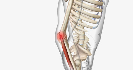 Tennis elbow, also called epicondylitis, is a painful condition caused by repetitive movement of the elbow. 3D renderingの写真素材