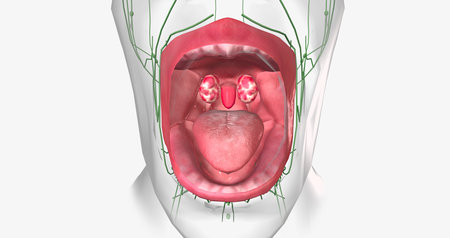 Strep throat is a common condition caused by a bacterial infection of the mouth and back of the oral cavity. 3D rendering.の写真素材