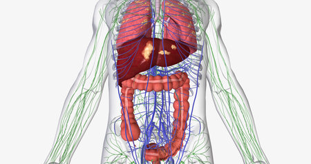 Colorectal cancer (CRC) is a common colon or rectal cancer that affects many patients over middle age. 3D renderingの写真素材