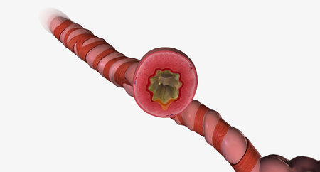 An asthma attack is the sudden narrowing of the airways in response to a trigger.3D renderingの写真素材