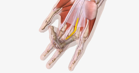 Dupuytrens contracture is a condition in which fibrotic tissue and collagen accumulate in the palmar aponeurosis. 3D renderingの写真素材
