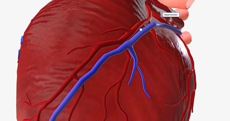 The Irregular Heartbeat and Hypertension 3D renderingの写真素材