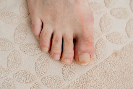 Close-up of a mans foot without manicure and toeの写真素材
