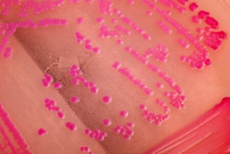 Helicobacter pylori bacteria - Top view