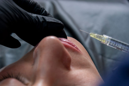 Closeup view of a syringe that is injecting hyaluronic acid into a womans lips