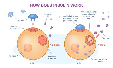 How does insulin work. Medical infographic with physiological process of glucose or sugar metabolism. Poster with educational scheme. Cartoon flat vector illustration isolated on white backgroundのイラスト素材