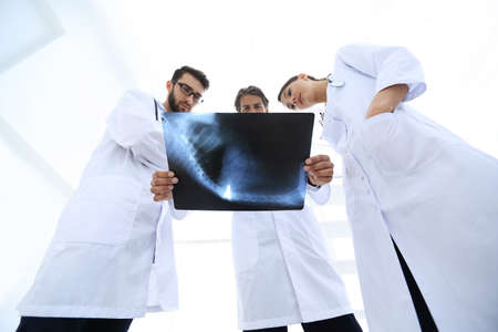 three doctors studying the patients X-ray filmの写真素材