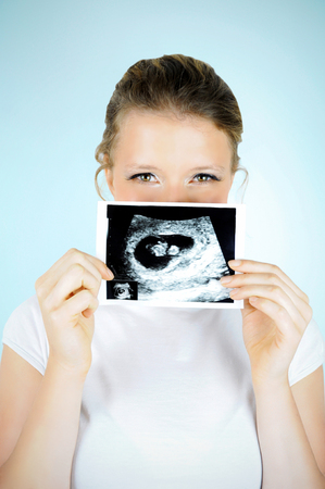 Beautiful smiling young woman in early pregnancy is posing with a baby scan photo.の写真素材