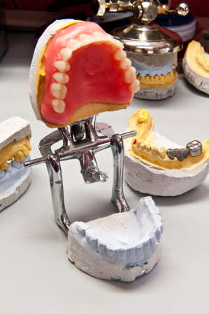 Mouth support device for wax teeth model. Wax teeth model on an metallic mouth special support.