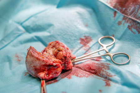 removal of benign tumor on the dogs paw by surgeryの写真素材