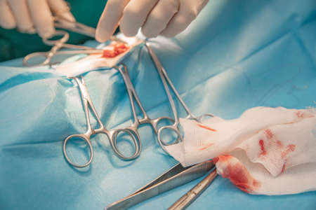 ligature of tissues at the time of surgical operation.の写真素材