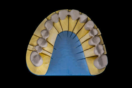Carcass of metal-ceramic teeth with the applied opaque layer.On a completely black background.