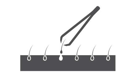 Illustration of tweezers and hair on the skin. Vector isolated editable flat illustrationのイラスト素材