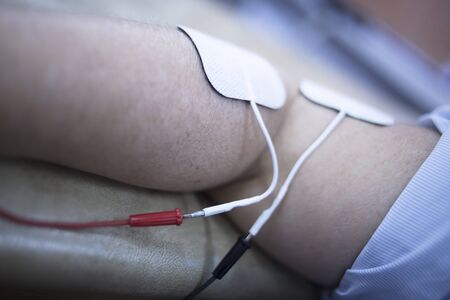 Female patient arm in physiotherapy rehabiliation treatment from injury in hospital clinic with electrical stimulus attached with plaster.の写真素材