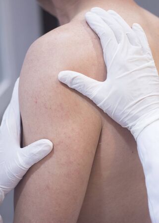 Male Traumatologist orthopedics surgeon doctor examining middle aged man patient to determine injury, pain, mobility and to diagnose medical treatment in shoulder, arm, elbow and wrist.の写真素材