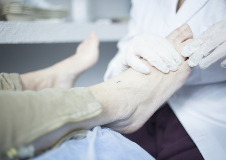 Podology podologist examining patient with chiropody treatment used to treat foot pain, muscles injuries, strains and tension in hospital physiotherapy clinic medical examination.の写真素材