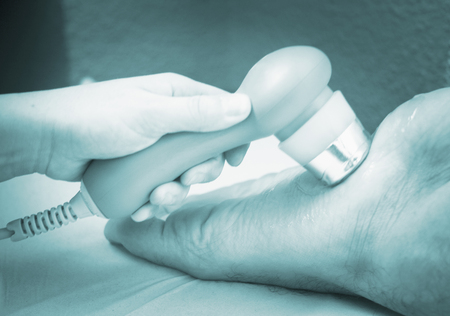 Electro stimulation used to treat pain, muscles injuries, strains and tension in hospital physiotherapy medical rehabilitation clinic for patient foot, heel and ankle.の写真素材