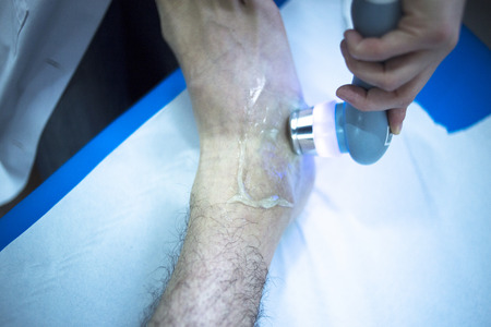 Electro stimulation used to treat pain, muscles injuries, strains and tension in hospital physiotherapy medical rehabilitation clinic for patient foot, heel and ankle.の写真素材