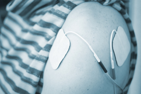Patient arm and shoulder in electro physiotherapy electrical impulse stimulation rehabiliation treatment from injury in hospital clinic with electrical stimulus attached with plaster.の写真素材