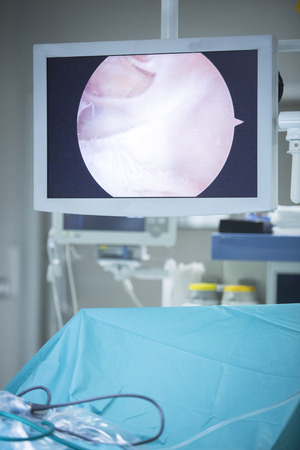 Traumatology orthopedic surgery hospital emergency operating room prepared for arthroscopy operation showing screen to view micro camera images.の写真素材