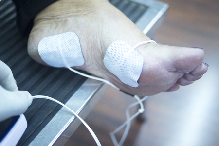 Patient foot, leg and ankle in electro physiotherapy electrical impulse stimulation rehabiliation treatment from injury in hospital clinic with electrical stimulus attached with plaster.の写真素材