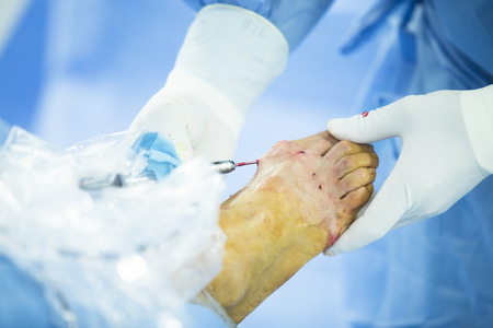Hospital emergency orthopedics and traumatology surgery operating room medical clinic real life photo in foot, ankle and leg arthroscopy orthopedic operation.の写真素材
