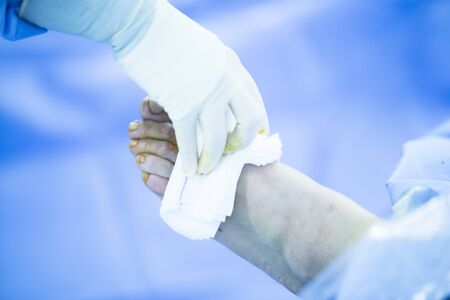 Hospital emergency orthopedics and traumatology surgery operating room medical clinic real life photo in foot, ankle and leg arthroscopy orthopedic operation.の写真素材