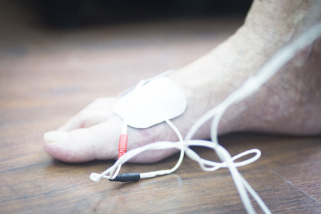 Patient foot, leg and ankle in electro physiotherapy electrical impulse stimulation rehabiliation...