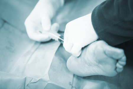 Hospital emergency orthopedics and traumatology surgery operating room medical clinic real life photo in foot, ankle and leg arthroscopy orthopedic operation.の写真素材