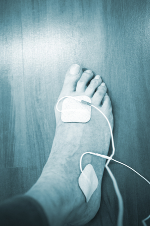 Patient foot, leg and ankle in electro physiotherapy electrical impulse stimulation rehabiliation treatment from injury in hospital clinic with electrical stimulus attached with plaster.の写真素材