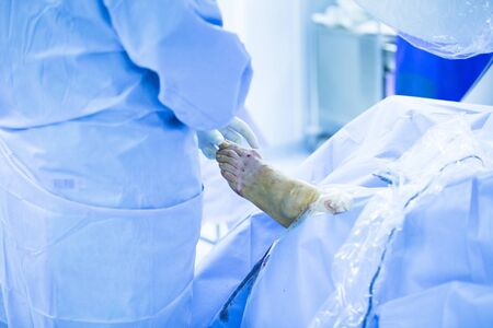 Hospital emergency orthopedics and traumatology surgery operating room medical clinic real life photo in foot, ankle and leg arthroscopy orthopedic operation.の写真素材