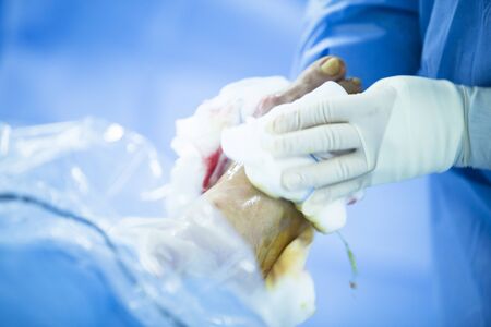 Hospital emergency orthopedics and traumatology surgery operating room medical clinic real life photo in foot, ankle and leg arthroscopy orthopedic operation.の写真素材