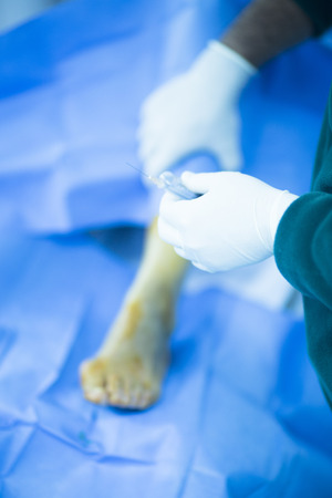 Hospital emergency orthopedics and traumatology surgery operating room medical clinic real life photo in foot, ankle and leg arthroscopy orthopedic operation.の写真素材