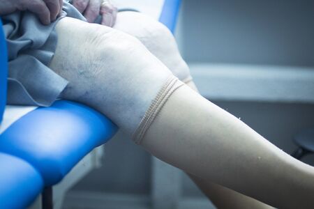 Patient leg in physical therapy physiotherapy clinic in medical center hospital rehabilitation room.の写真素材