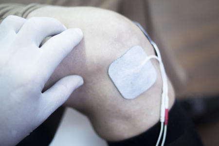 Patient leg and knee in electro physiotherapy electrical impulse stimulation rehabiliation treatment from injury in hospital clinic with electrical stimulus attached with plaster.の写真素材