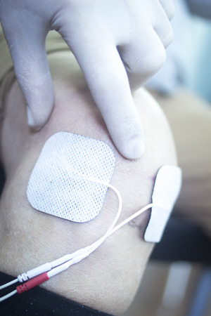 Patient leg and knee in electro physiotherapy electrical impulse stimulation rehabiliation treatment from injury in hospital clinic with electrical stimulus attached with plaster.の写真素材