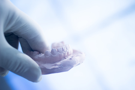Dental mold dentist clay teeth plate ceramic colored cast model showing tooth decay of patient in...