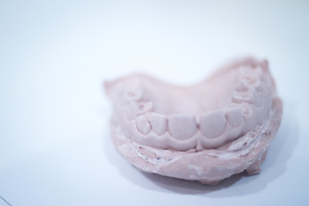 Dental mold dentist clay teeth plate ceramic colored cast model showing tooth decay of patient in...
