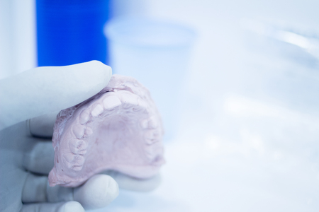 Dental mold dentist clay teeth plate ceramic colored cast model showing tooth decay and gums of...