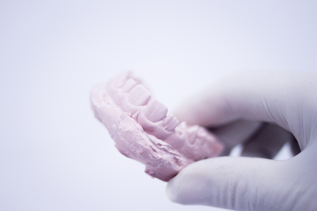 Dental mold dentist clay teeth plate ceramic colored cast model showing tooth decay and gums of...