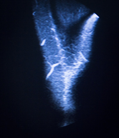 MRI magnetic resonance imaging medical scan test results showing ligaments, cartilege and cross...
