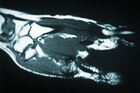 MRI magnetic resonance imaging medical scan test results showing ligaments, cartilege and cross section of bones in human skeleton.の写真素材