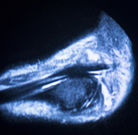MRI magnetic resonance imaging medical scan test results showing ligaments, cartilege and cross section of bones in human skeleton of ankle.の写真素材