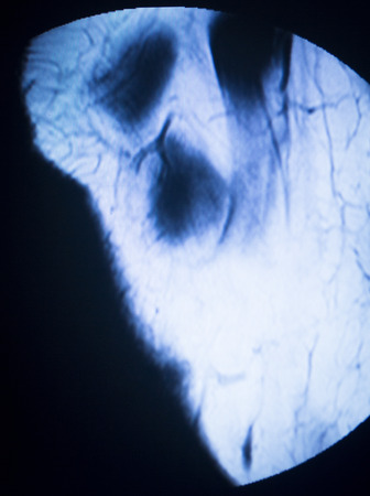 MRI magnetic resonance imaging medical scan test results showing knee joint, meniscus, femur, thigh and calf of leg, ligaments, cartilege and cross section of bones in human skeleton.の写真素材