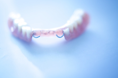 Removable partial denture metal and plastic dental false teeth prosthetics.の写真素材